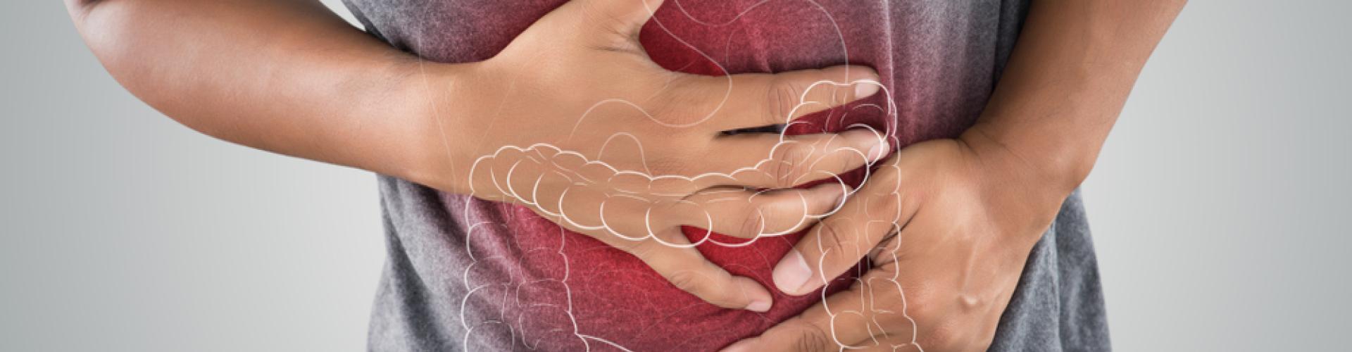 Syndrome intestin irritable