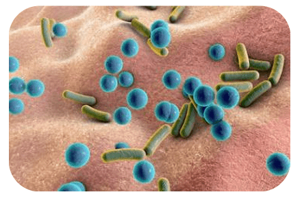 dysbiose intestinale