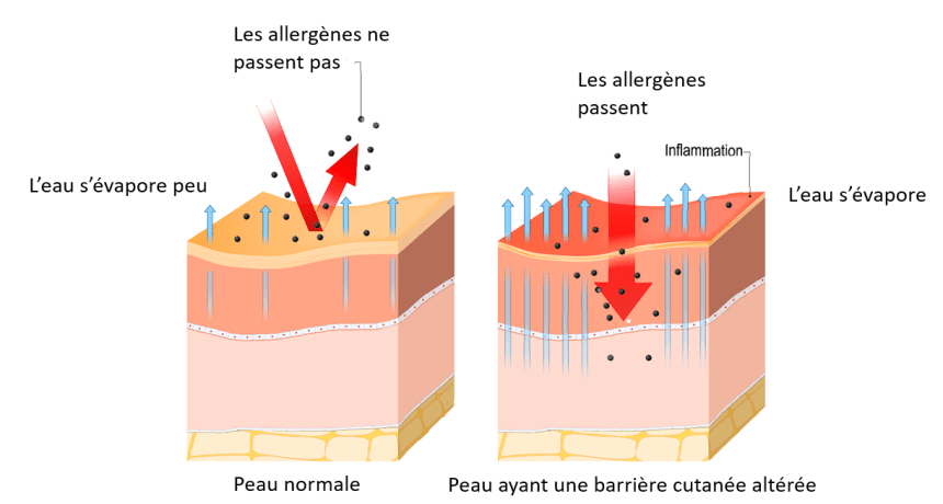 Peau normale vs peau altérée