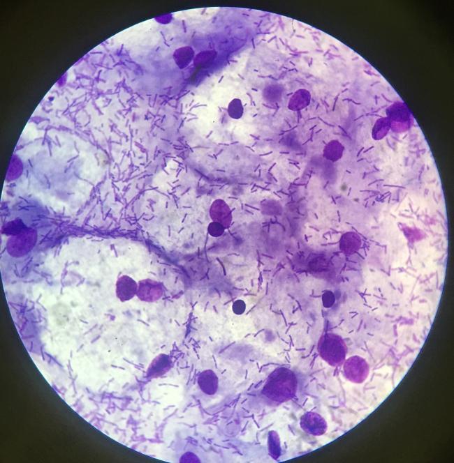 Flore vaginale