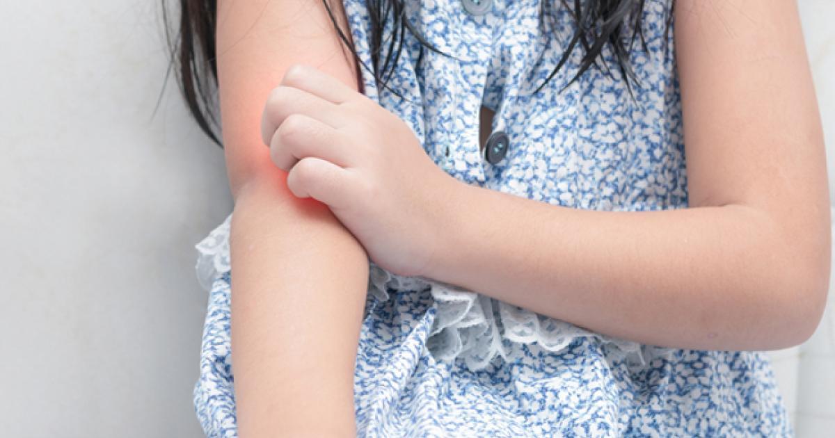 Microbiote Intestinal Et Prevention Des Allergies